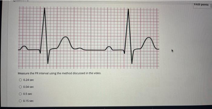 Solved Measure the PR interval using the method discussed in | Chegg.com