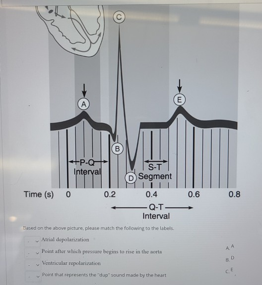 Solved E А. B) P-Q Interval S-T Segment Time (S) 0 0.2 0.6 | Chegg.com Solved E А. B) P-Q Interval S-T Segment Time (S) 0 0.2 0.6 | Chegg.com