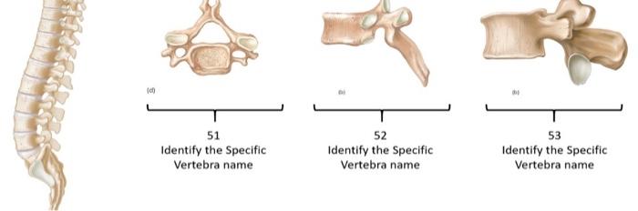 Solved 49 50 10 51 Identify the Specific Vertebra name 52 | Chegg.com