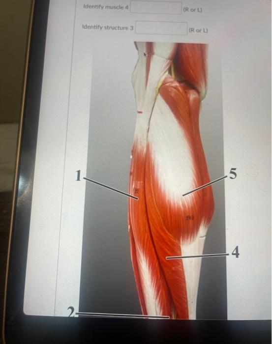 Solved Identify muscle 3 (R or 4) Identify muscle 5 (R or | Chegg.com