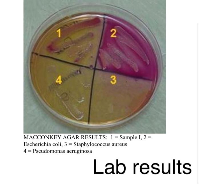 Solved Media: Enriched, Differential, And Selective L 