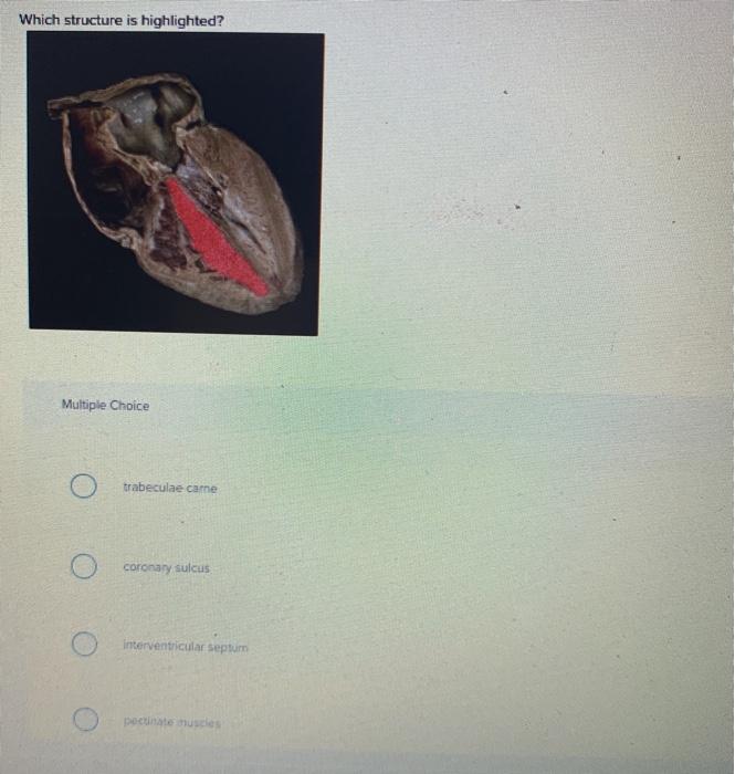 interventricular sulcus and septum