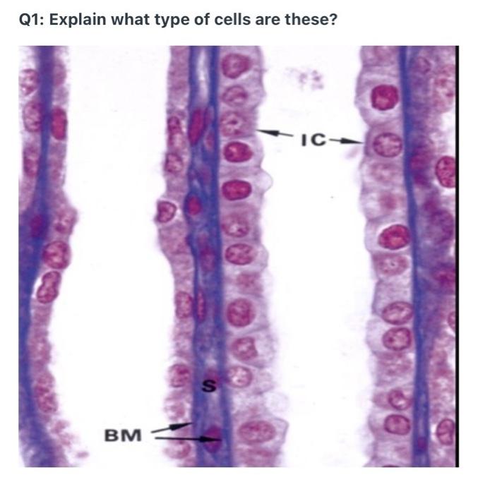 Solved Q1: Explain what type of cells are these? IC- BM | Chegg.com