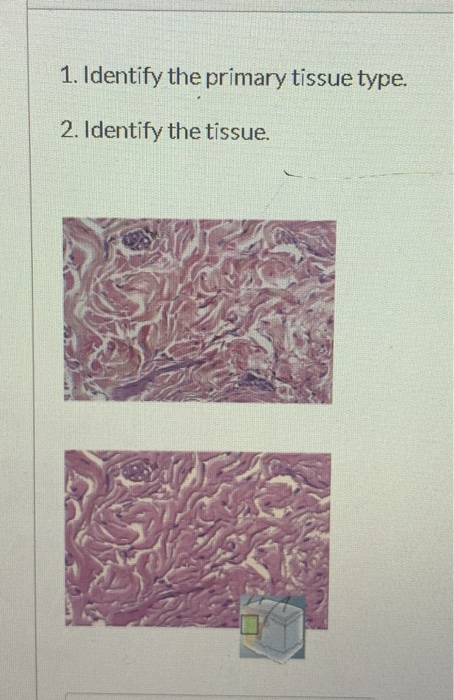 Solved 1. Identify the primary tissue type. 2. Identify the | Chegg.com