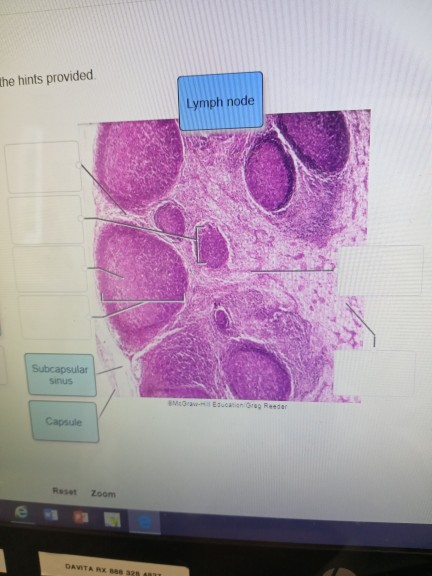 Solved the hints provided Lymph node Subcapsular Sinus | Chegg.com