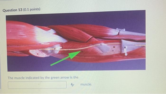 Question 13 (0.1 points) The muscle indicated by the green arrow is the A/ muscle.