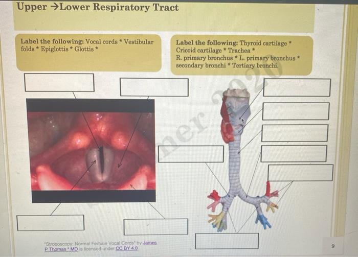 Solved Upper Lower Respiratory Tract Label the following: | Chegg.com