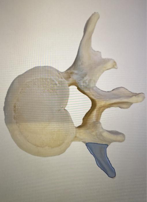 Solved Transverse Process Superior Articular Facet | Chegg.com