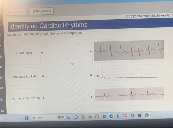Solved Identifying Cardiac Rhythms Match each rhythm image | Chegg.com