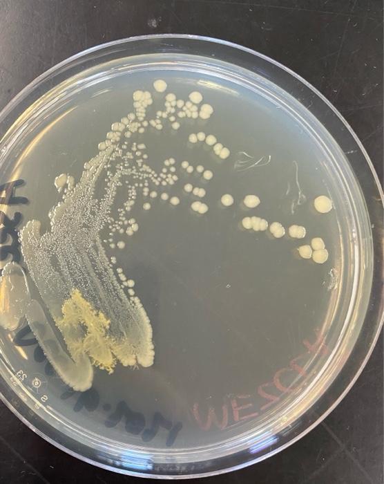 Solved General microbiology Using the quadrant streaking | Chegg.com