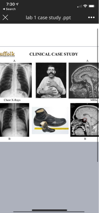 case study on x ray