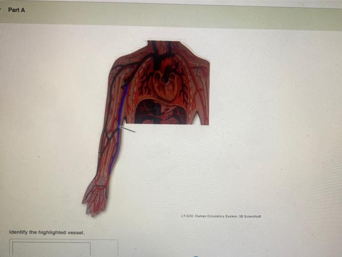 Solved Part A Identify the highlighted vessels. n Derson
