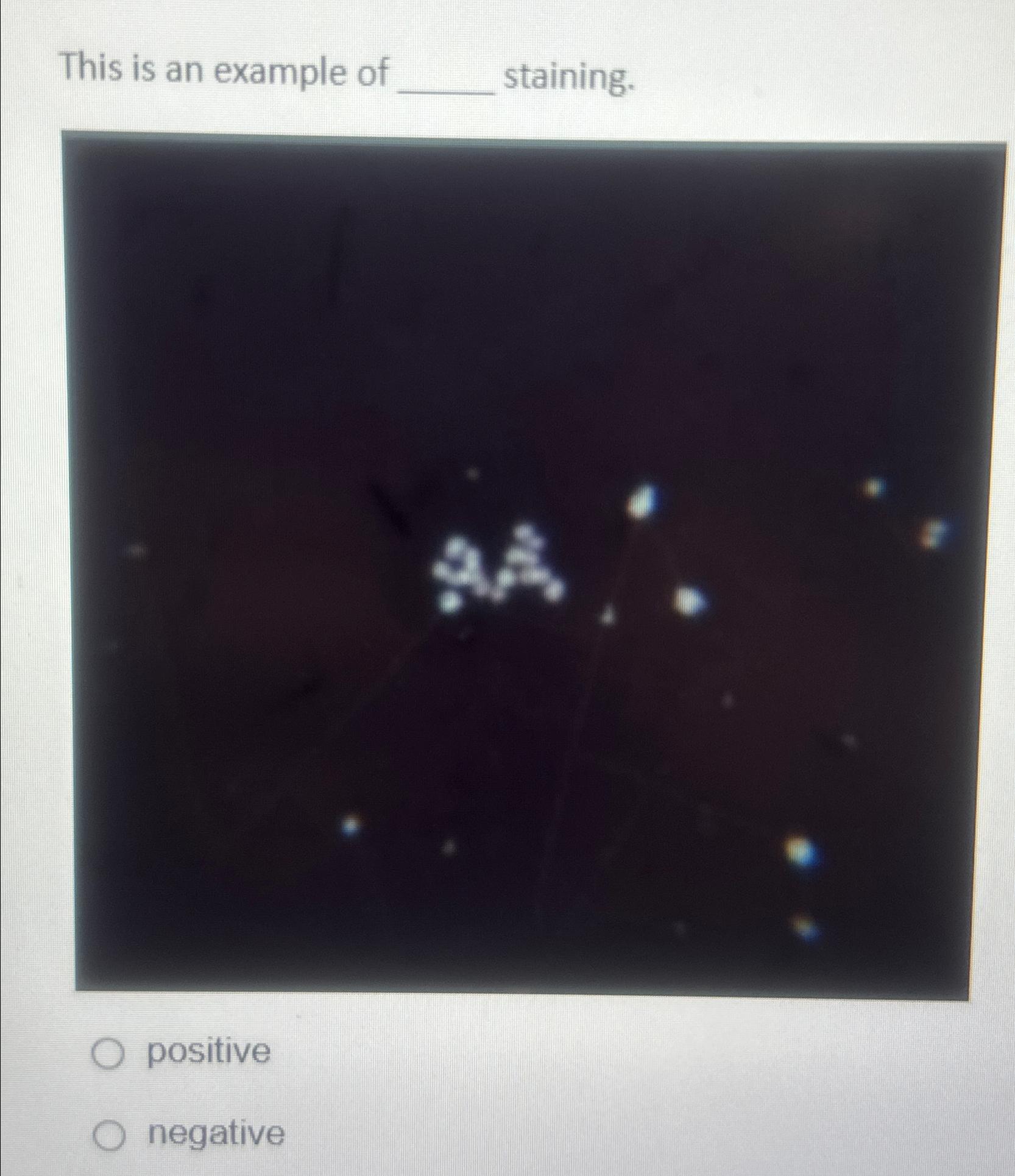 Solved This is an example of staining.positivenegative | Chegg.com