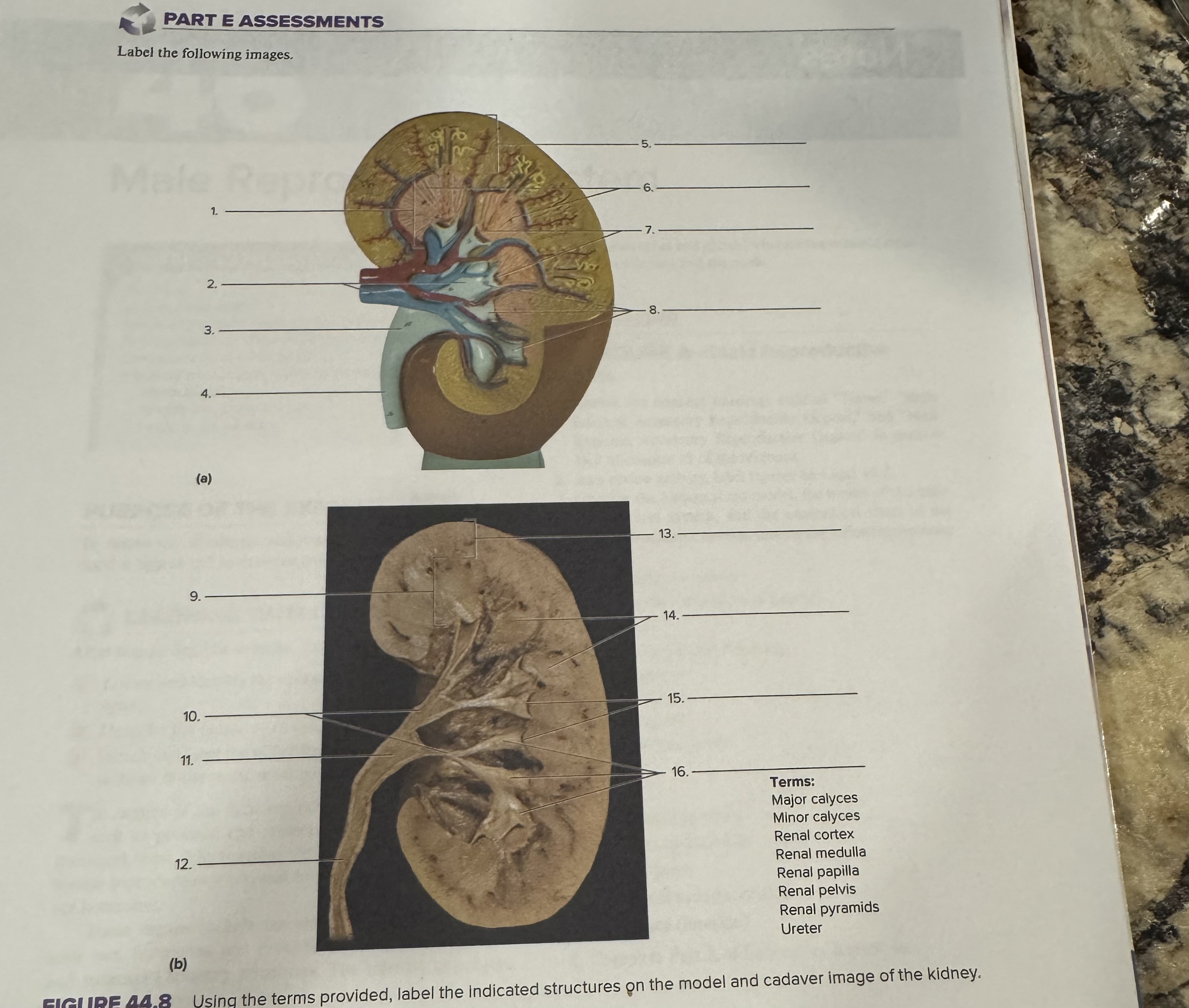 Solved PART E ASSESSMENTSLabel the following | Chegg.com