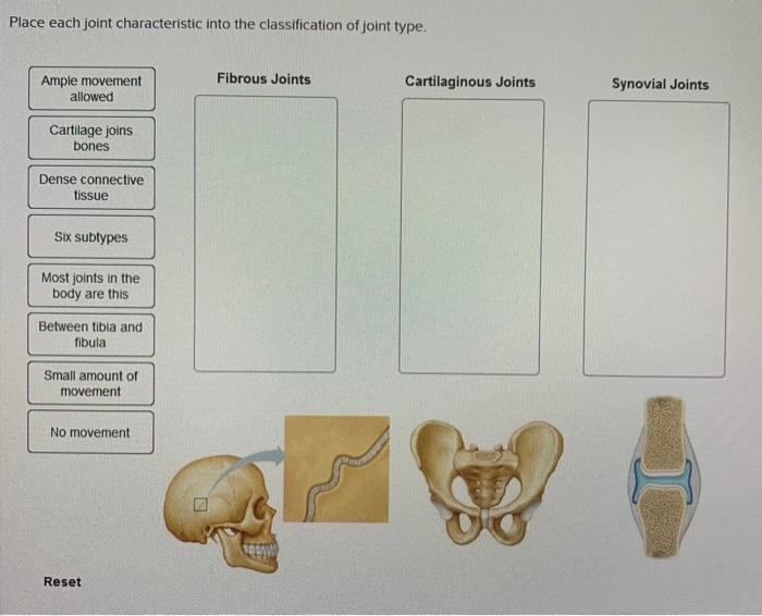 Solved Place each joint characteristic into the