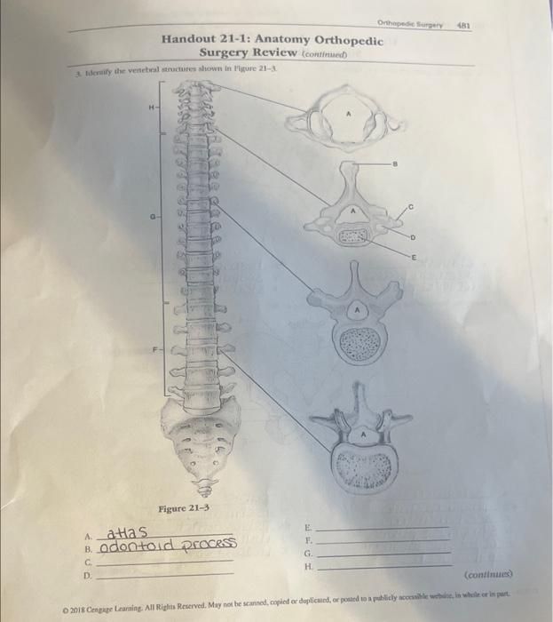 Solved Handout 211 Anatomy Orthopedic Surgery Revicw