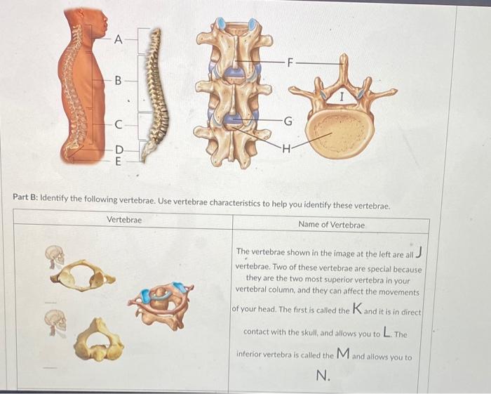 Solved A B 臺 C H D E Part B: Identify the following | Chegg.com