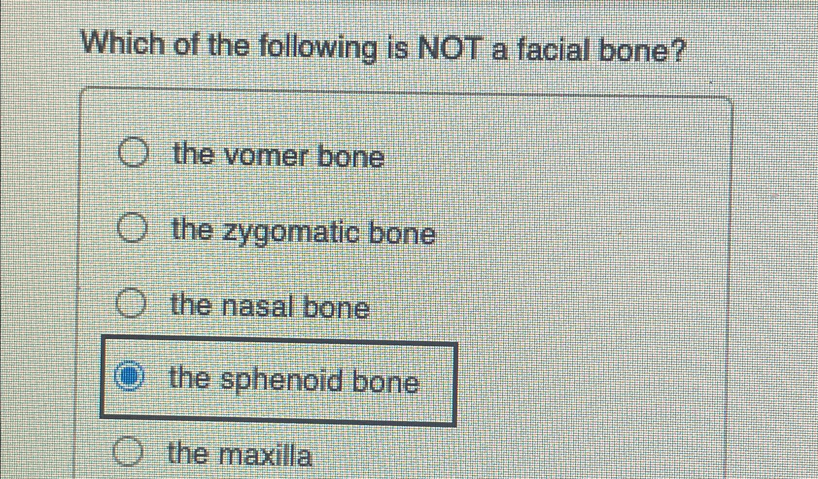 Solved Which Of The Following Is Not A Facial Bone?the Vomer 