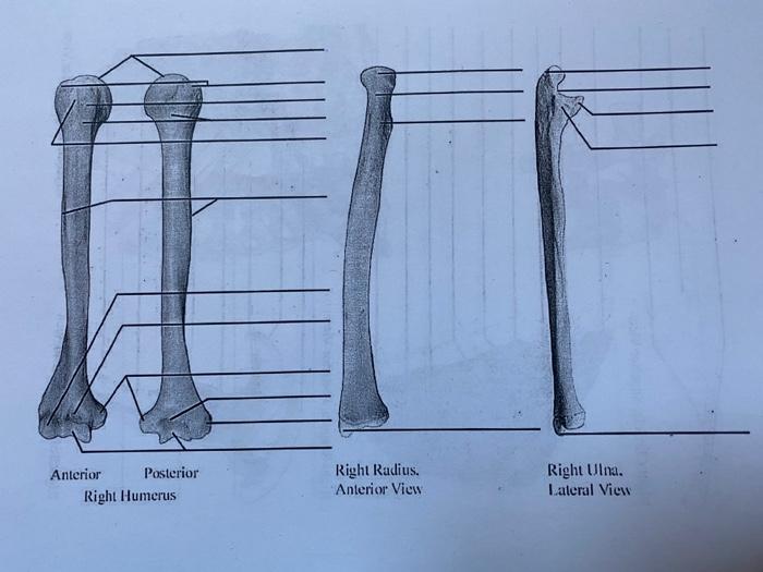 Solved Anterior Posterior Right Humerus Right Radius. | Chegg.com