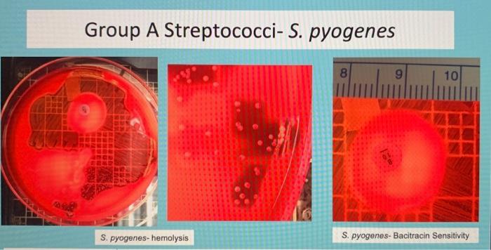 Solved Streptococcus Demo Gram-positive cocci in chains or | Chegg.com