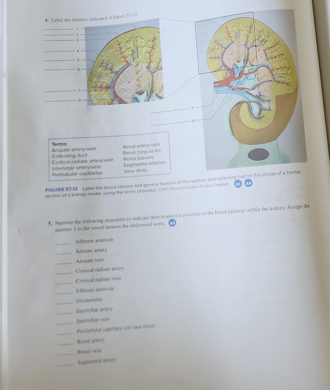 Solved FIGURE 57.12 Label the blood vessels and general | Chegg.com