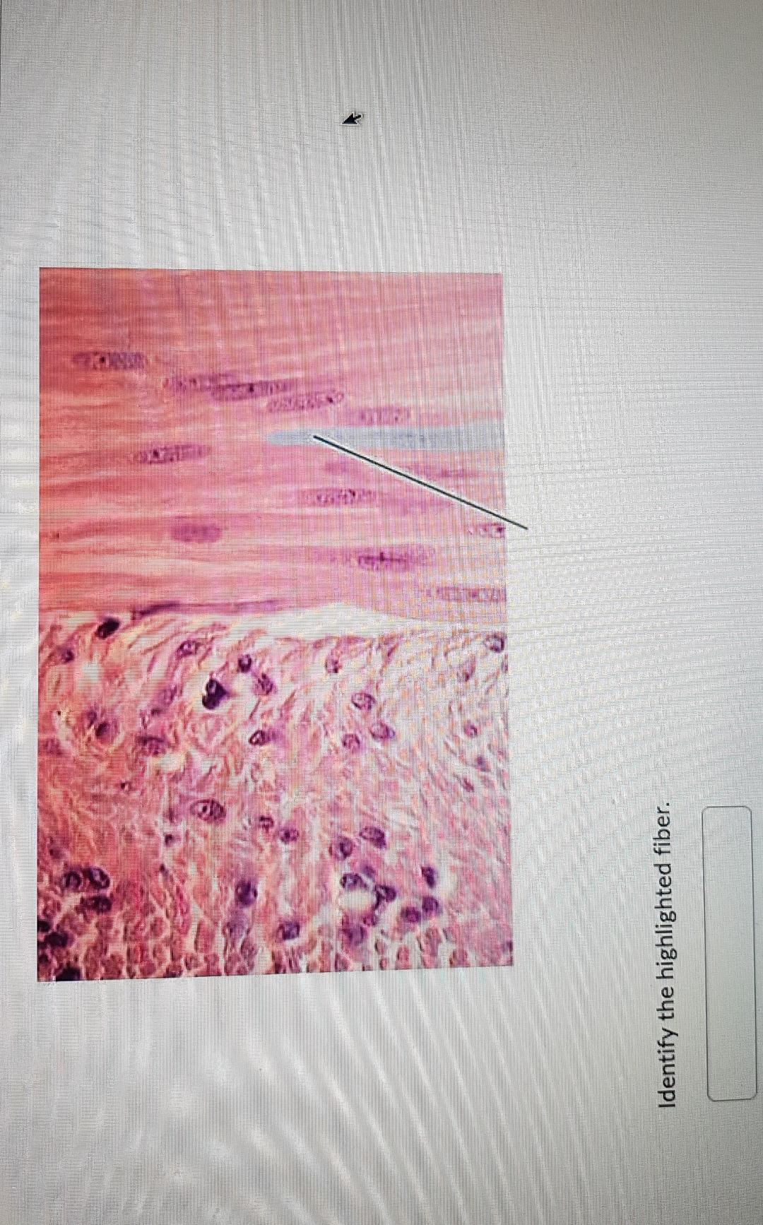 Identify the highlighted fiber. | Chegg.com