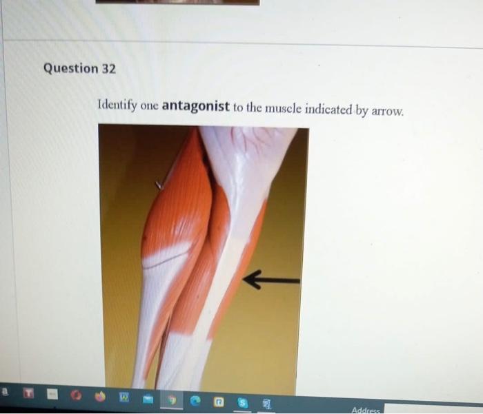 Solved Question 32 Identify one antagonist to the muscle | Chegg.com