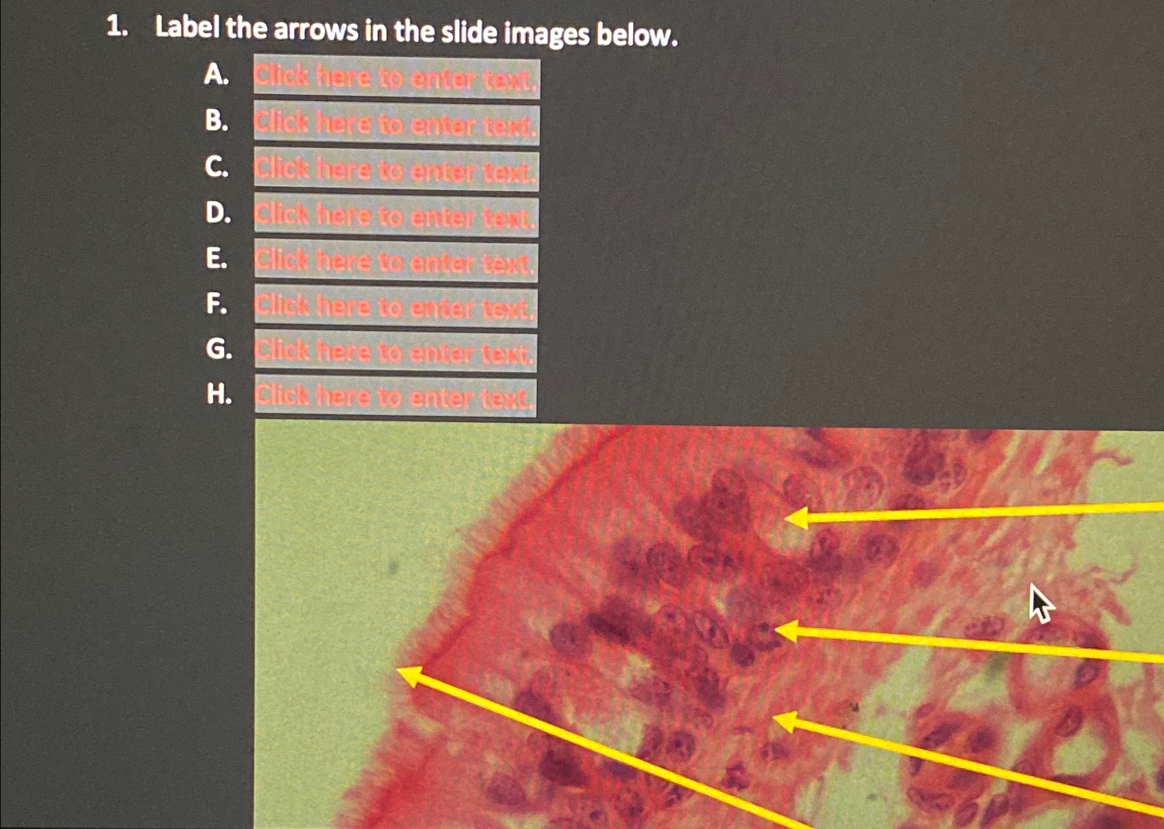 Solved Label the arrows in the slide images | Chegg.com