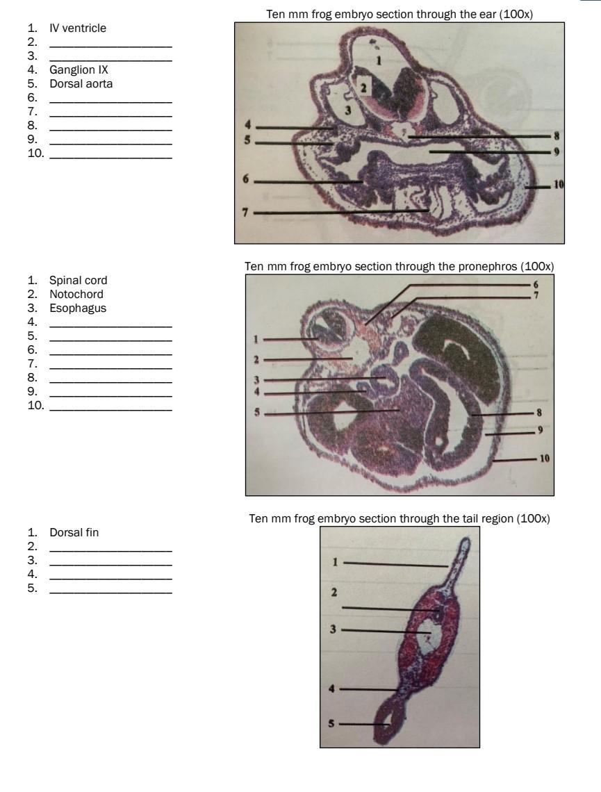 Solved Label the structures of the late embryonic | Chegg.com