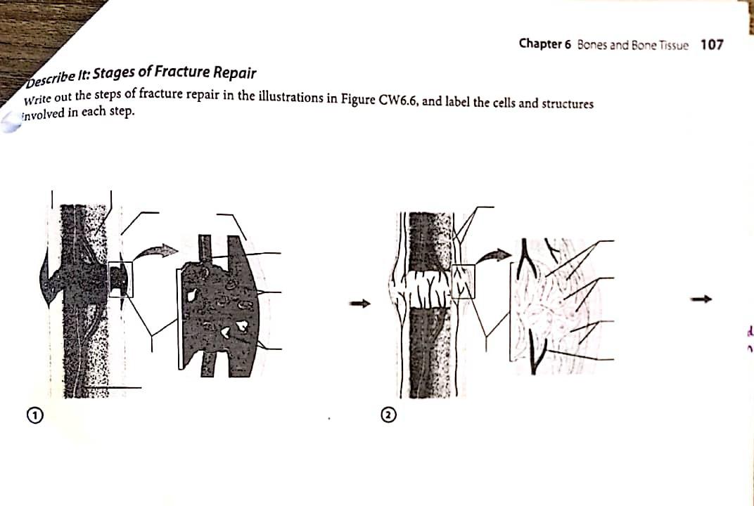 Solved write out the steps of fracture repair in the