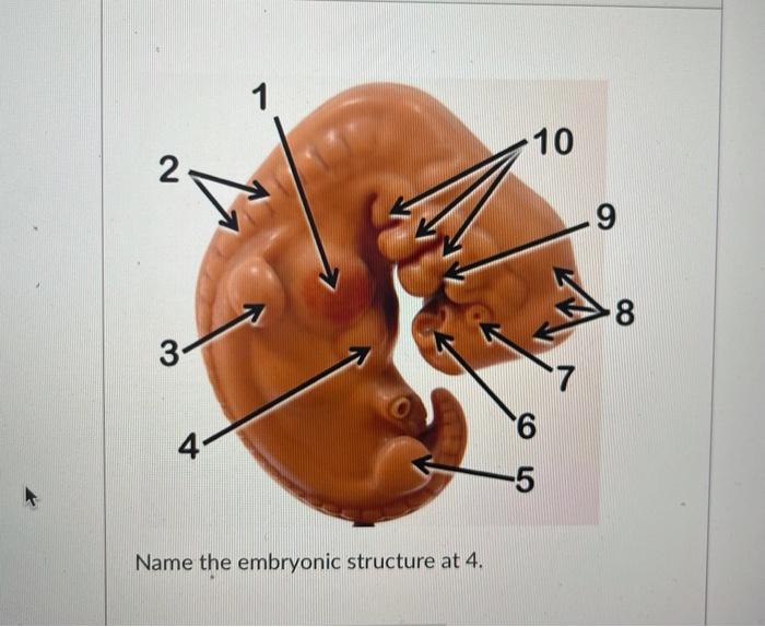 Solved Name the embryonic structure at 4. | Chegg.com