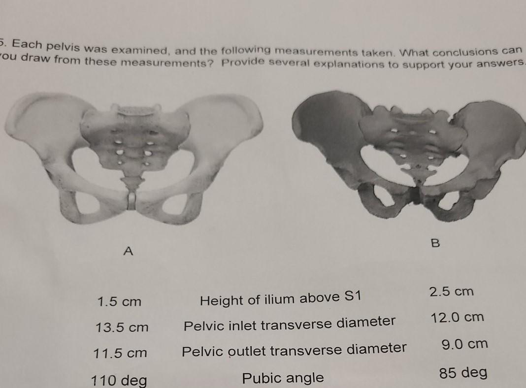 💡| معلومة إشعاعية Difference between inlet view and outlet view🩻🤔🔎  #معلومات_اشعاعية, image size:1068x788