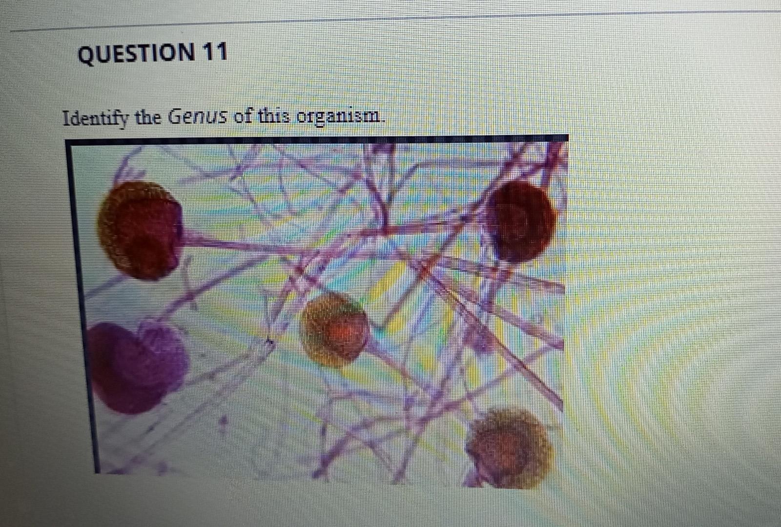 Solved QUESTION 11 Identify The Genus Of This Organism. | Chegg.com