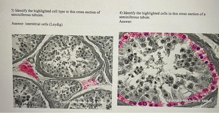 seminiferous tubules cross section