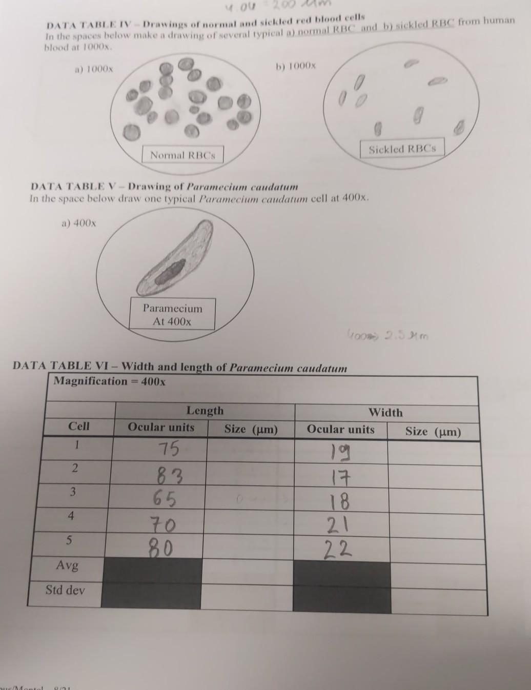 Solved DATA TABLE VII - Drawings of yeast cells In the | Chegg.com, image size:1036x1346