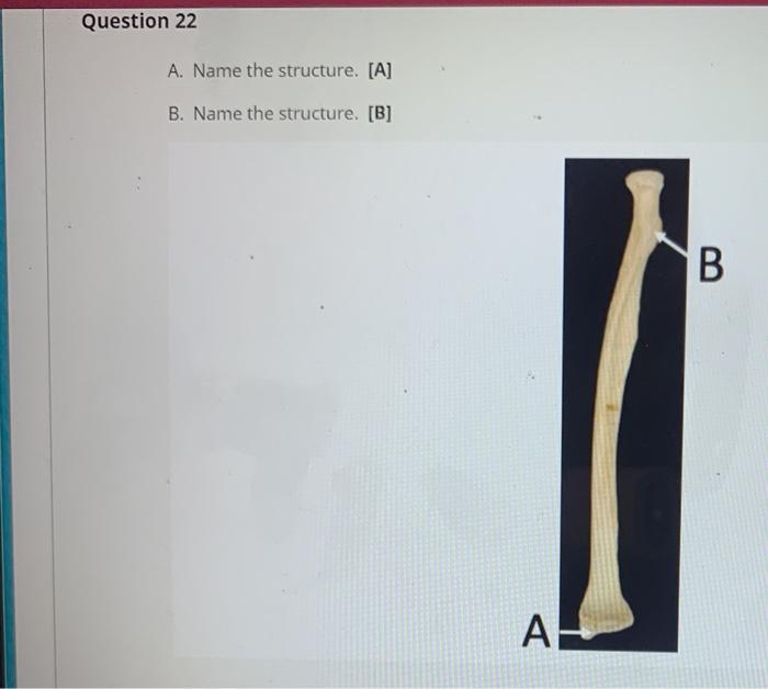 Solved Question 21 : A. Name The Structure. [A] B. Name The | Chegg.com