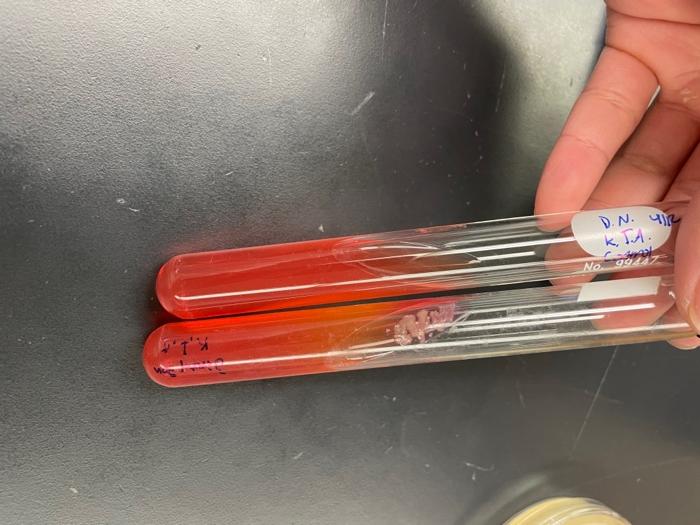 Solved Kligler Iron Agar Slants Test based on my results | Chegg.com