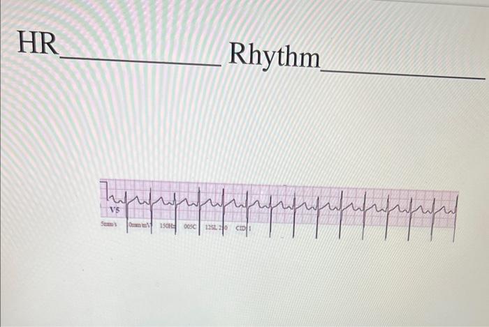 Solved HR Rhythm | Chegg.com