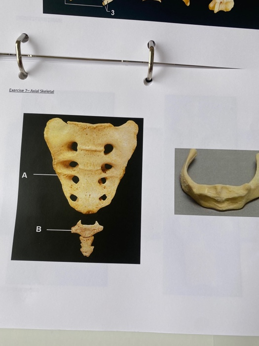 Solved Exercise 7-Axial Skeletal A B | Chegg.com