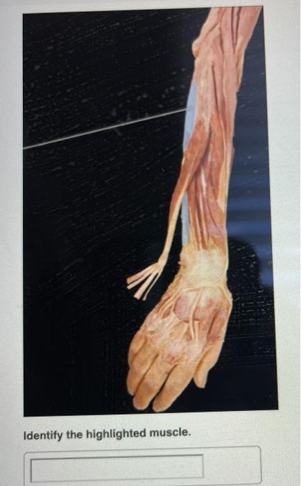 Solved Muscular System: Upper Limb > Lab Practical PAL: | Chegg.com