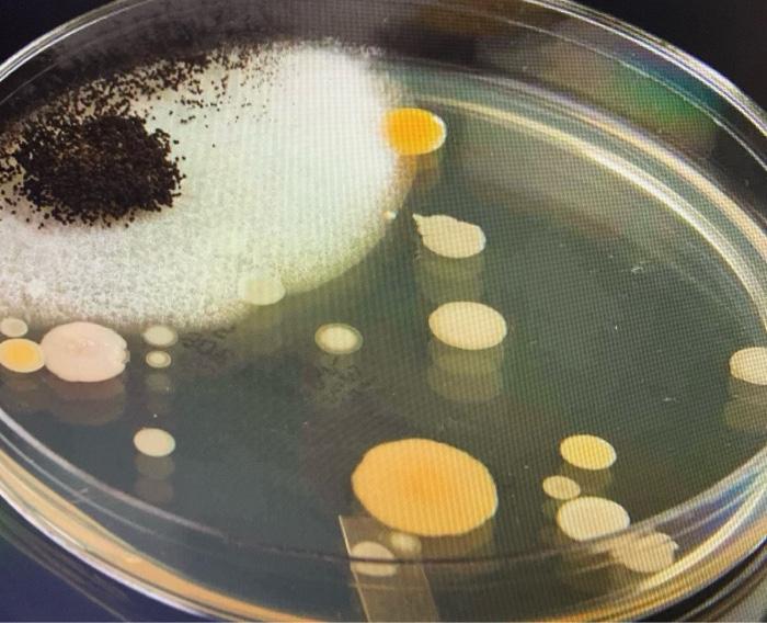 Solved Refer To The Colony Morphology Chart In The Link | Chegg.com