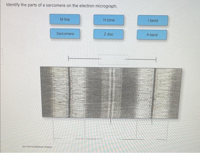 Solved LABEL BOTH PLEASE Identify The Parts Of A Sa   Image