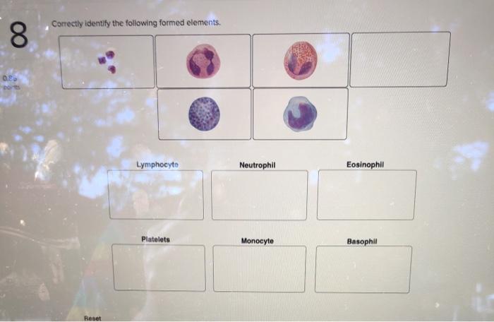 solved-correctly-identify-the-following-formed-elements-00-chegg