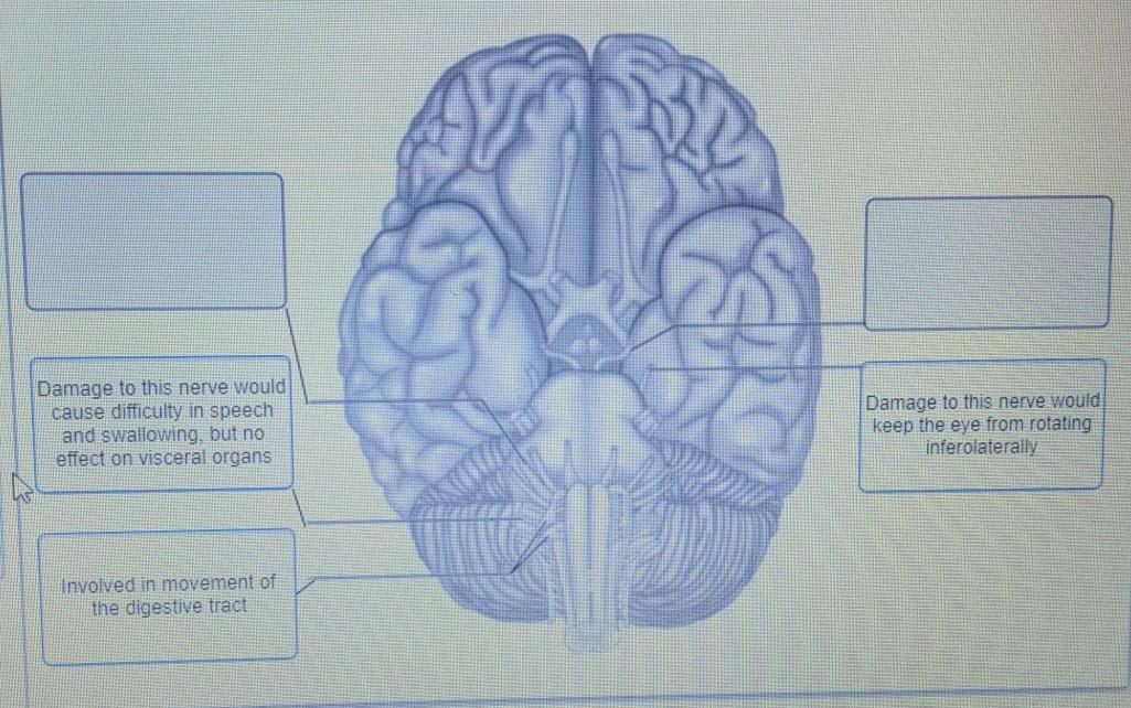 solved-damage-to-this-nerve-would-cause-difficulty-in-speech-chegg