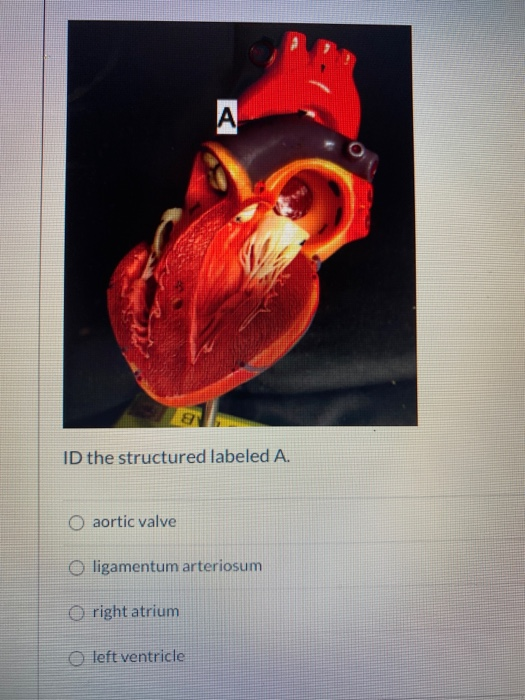 Solved A ID the structured labeled A. O aortic valve O | Chegg.com