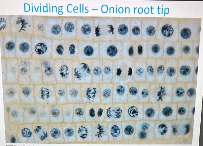 Dividing Cells - Onion root tip