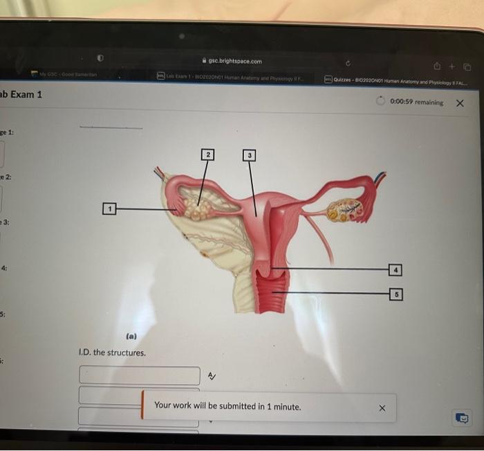 Solved I.D. the structures. | Chegg.com