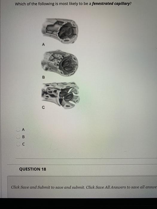 Solved Which of the following is most likely to be a | Chegg.com