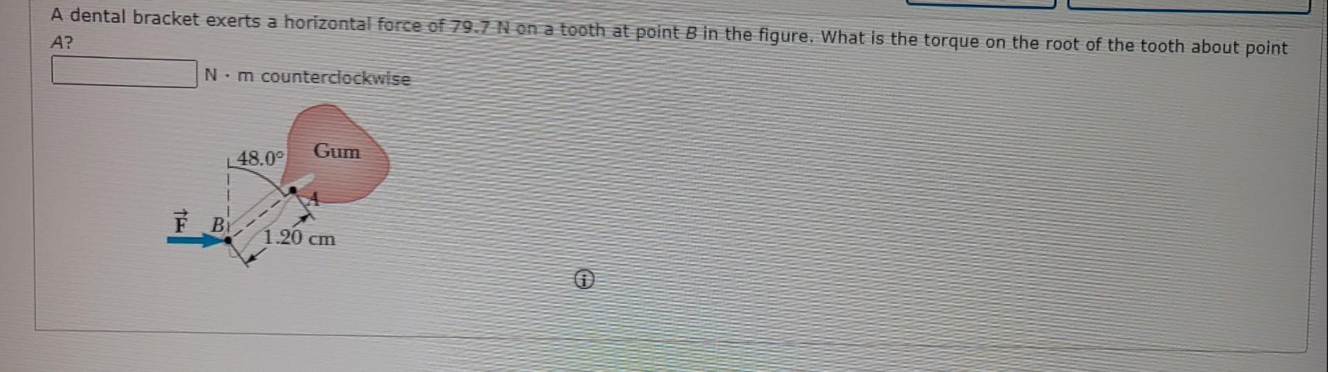 Solved A dental bracket exerts a horizontal force of 79.7 N