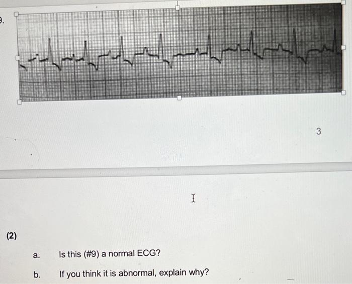 Solved 3 (2) A. Is This (\#9) A Normal ECG? B. If You Think | Chegg.com